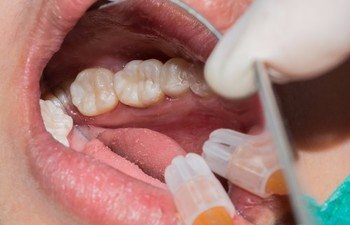 Conditions that Cause Gum Discomfort