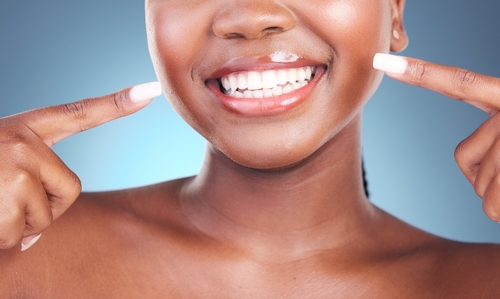 Professional Teeth Whitening in Buffalo, NY | Free Consultations